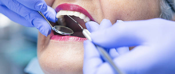 Best Knocked-Out Tooth (Avulsed Tooth) Treatment in Vancouver, WA