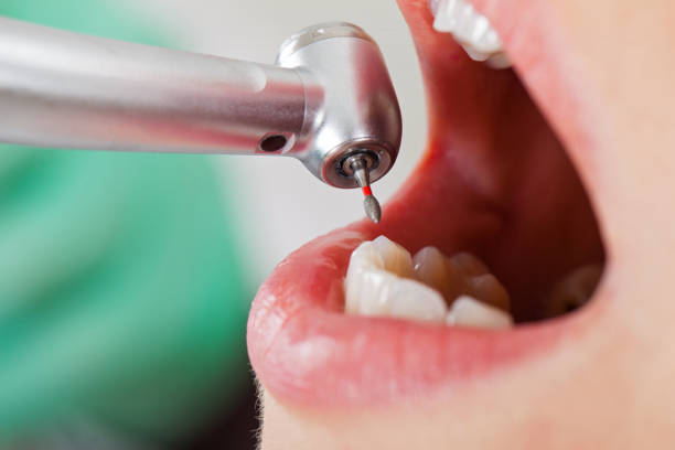 Best Emergency Treatment for Jaw Pain or Injury in Vancouver, WA